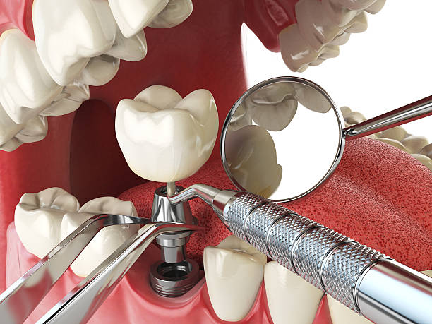 Best Broken or Cracked Tooth Emergency Dentist in Marvin, NC