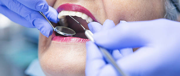 Best Emergency Root Canal Treatment in Marvin, NC